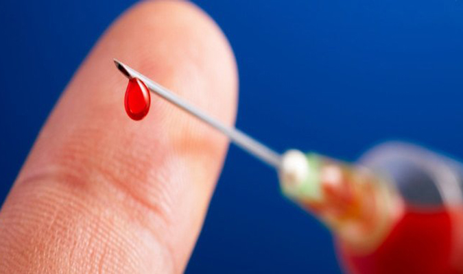 Cách sơ cứu khi vô tình bị kim tiêm nhiễm máu HIV | VIAM